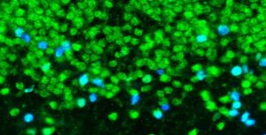 [EURL in neurons] Image of fluorescence staining to identify EURL in nerve cells of the brain (cyan) [Image credit: Julian Heng]